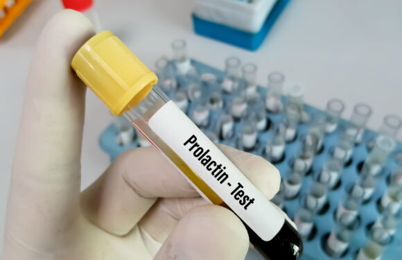 Hiperprolaktynemia – czym jest? Objawy i przyczyny